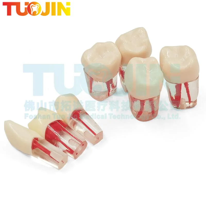 5pcs Dental Endodontic Teeth Practice Model Training Root Canal Files Study Blocks Resin RCT Demo Student Dentistry Teaching