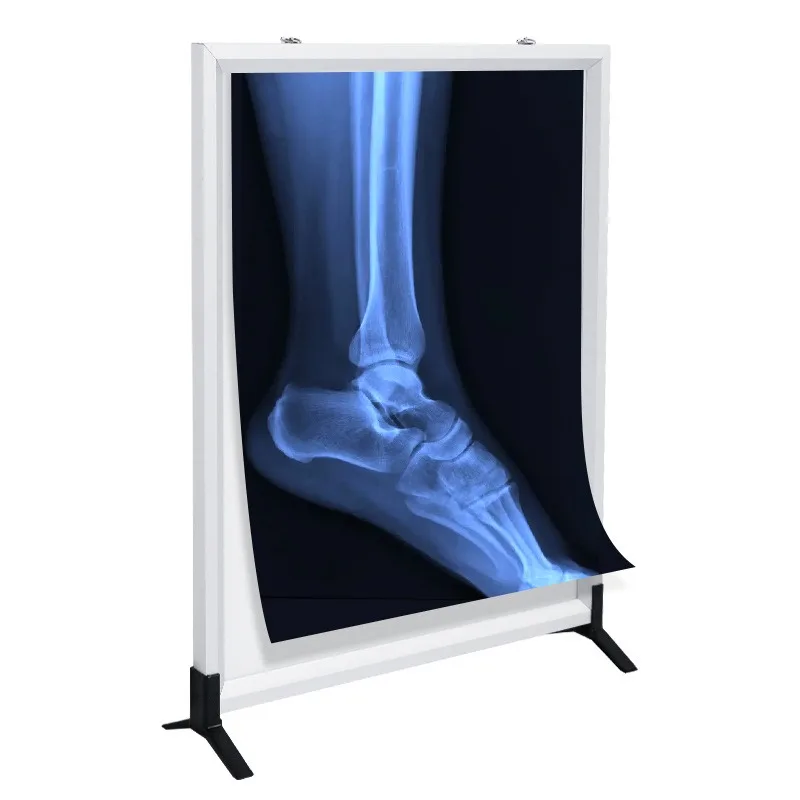 Genuine x-ray viewing light medical led ultra-thin viewing light box