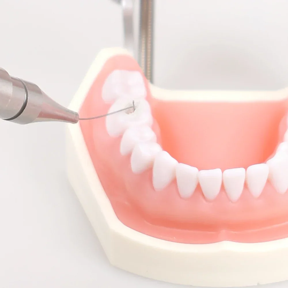 SYJH avec 4 têtes métalliques + 1 extracteur de fichiers dentaires cassés, extracteur de fichiers de Canal radiculaire pratique, outils d'instruments de dentiste