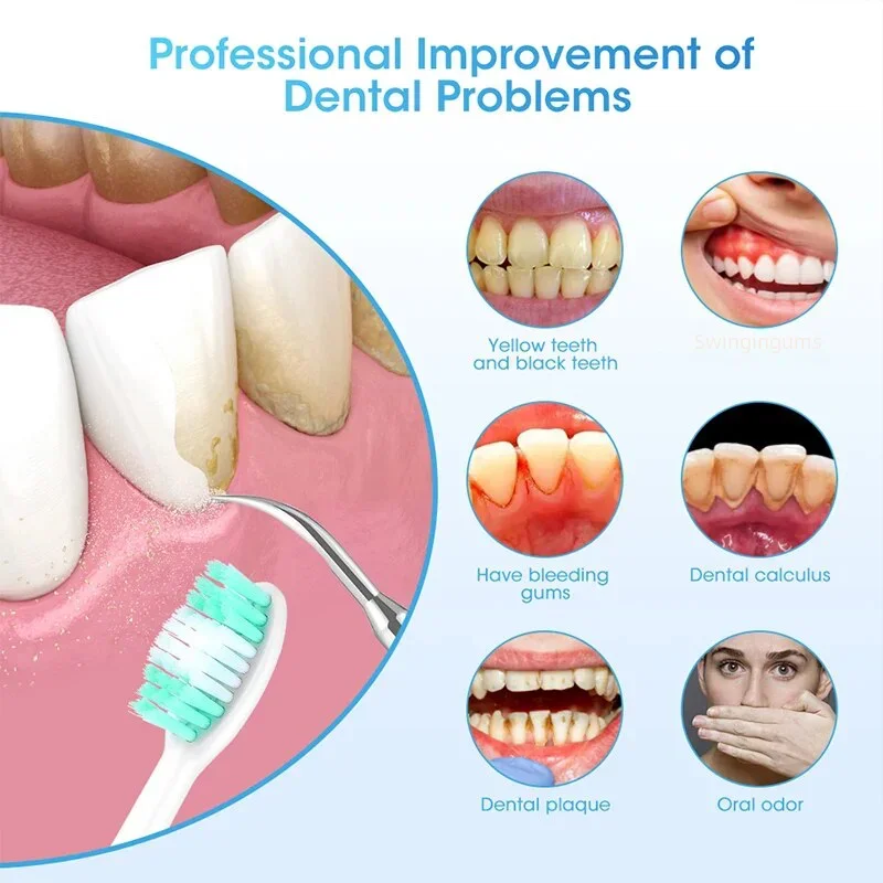 Removedor de manchas de dientes sónico eléctrico, escalador Dental ultrasónico, sarro, placa de dientes sónica