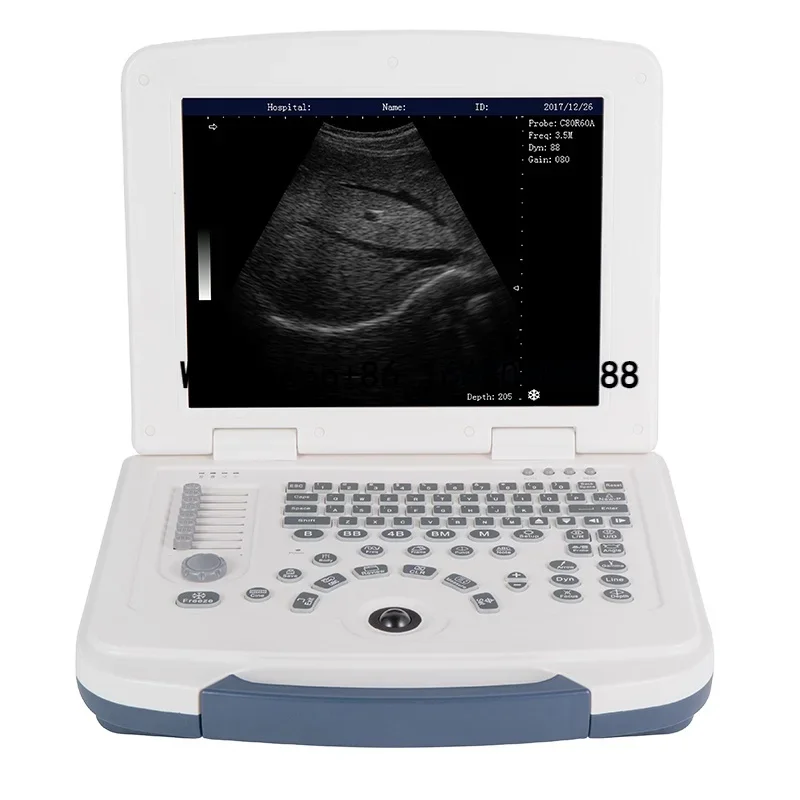 

Medical Ultrasound Machine laptop portable ultrasound scanner machine YC-580 by Yicare