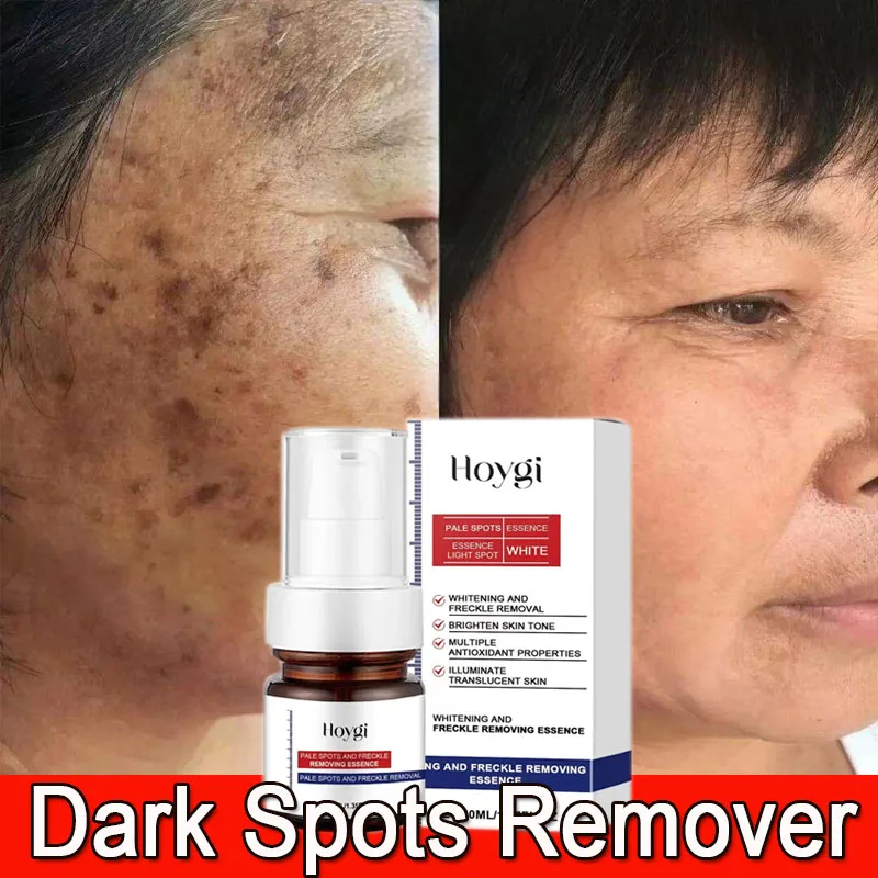 

Vitamin C Cream Dark Spots Remover Melasma Lightening Face Rejuvenation Anti Freckle Brightening Moisturizing Skin Care Products