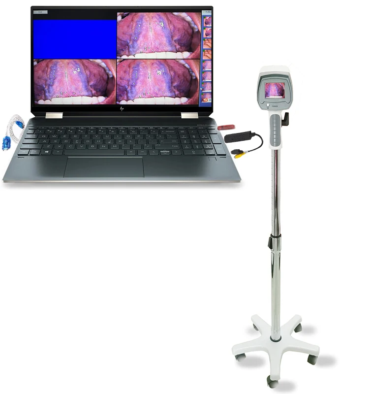 

Digital Video Price Electronic Portable For Gynecology