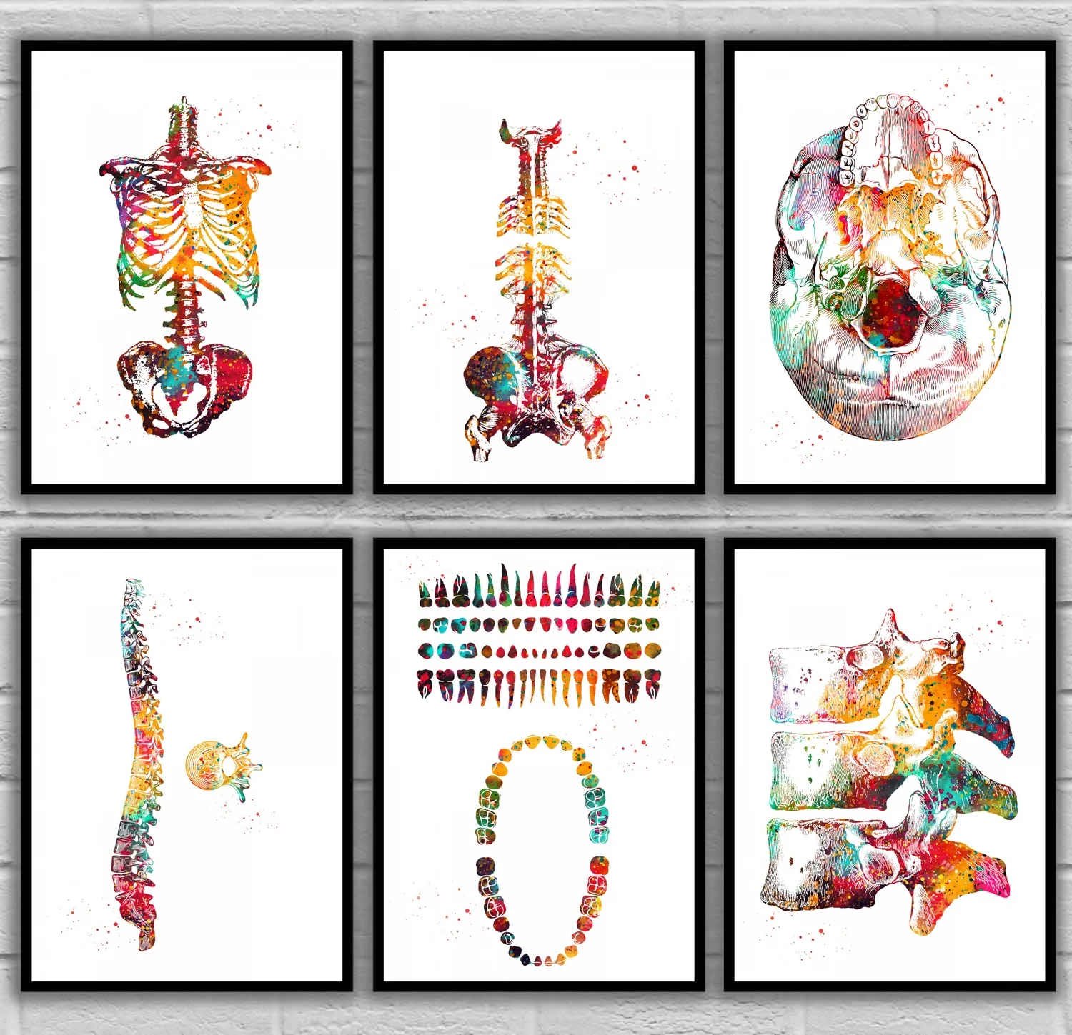 1 pièce -- Peinture sur toile médicale et scientifique représentant un squelette, un torse, un crâne, la colonne vertébrale, les vertèbres, les dents, la poitrine et la structure dentaire.