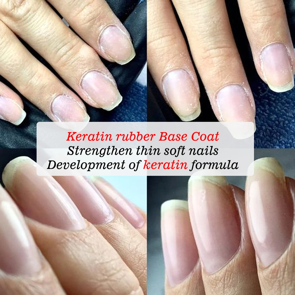 KODIES GEL Keratin Formula Rubber Base Coat Gel Nail Polish Strengthen Nails Soak Off UV/LED Clear Base Primer Repair Thin Nails