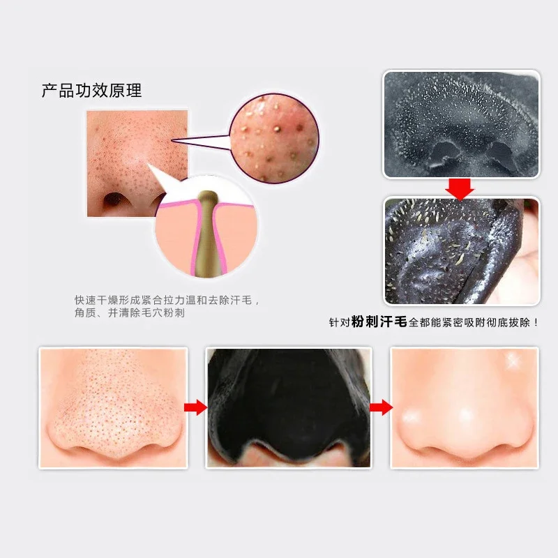 1pc blackhead sticker Pore Cleaner Black Dots Acne Treatment Blackhead Nose sticker Deep Clean Nose Blackhead Remover Mask