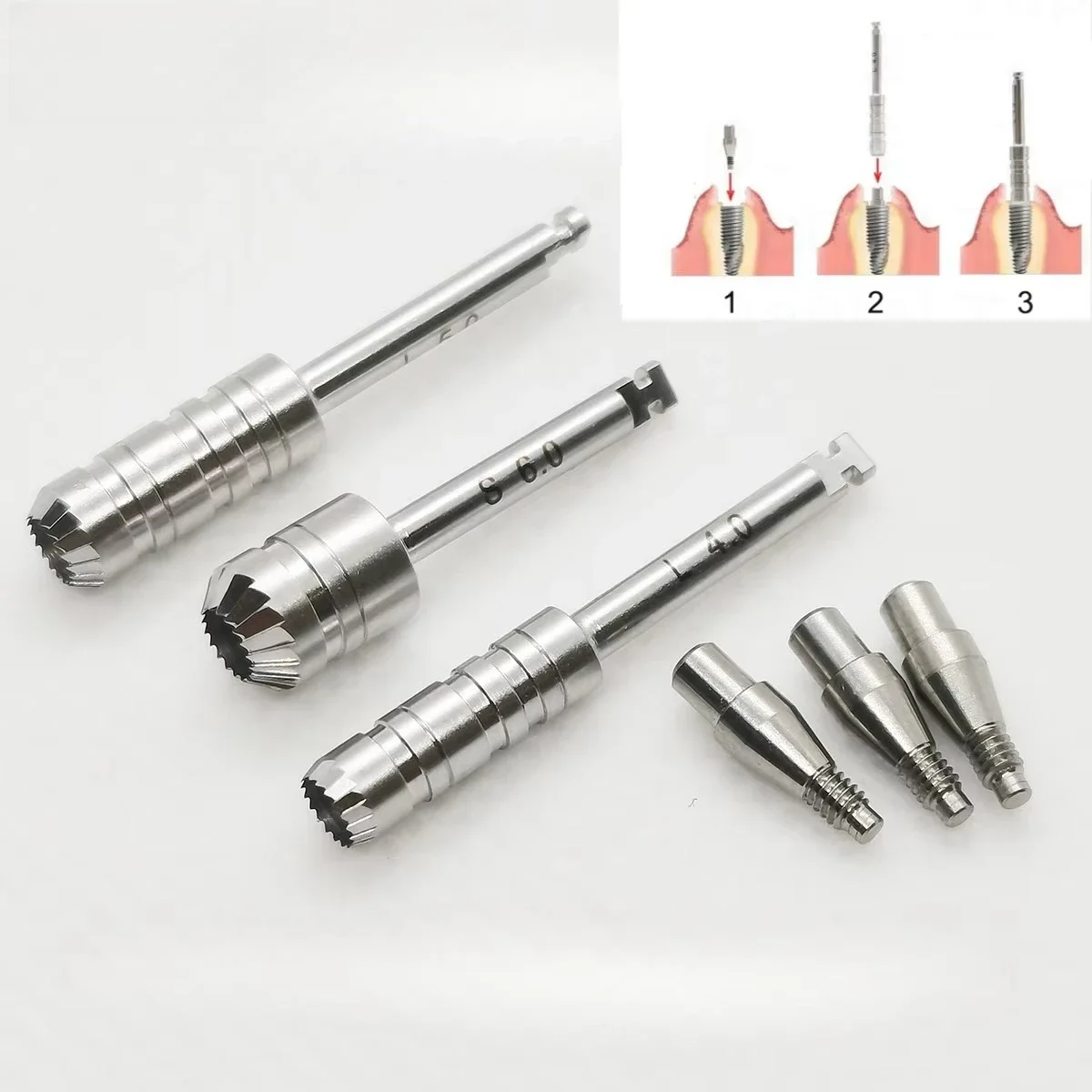 Dental Implant Bone Profiler Guide Screw Surgical Instrument Bone Grinding Oral Implant Peripheral Bone Fit for OSSTEM Dentium