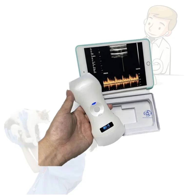 ultrasound for phone Medical Handheld Color Doppler USB Linear mini ultrasound probe