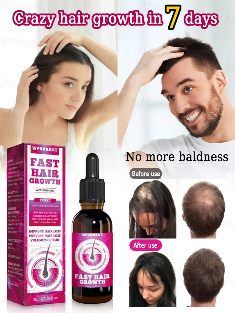 

Fast Hair Growth Serum Baldness Treatment Anti-Hair Loss