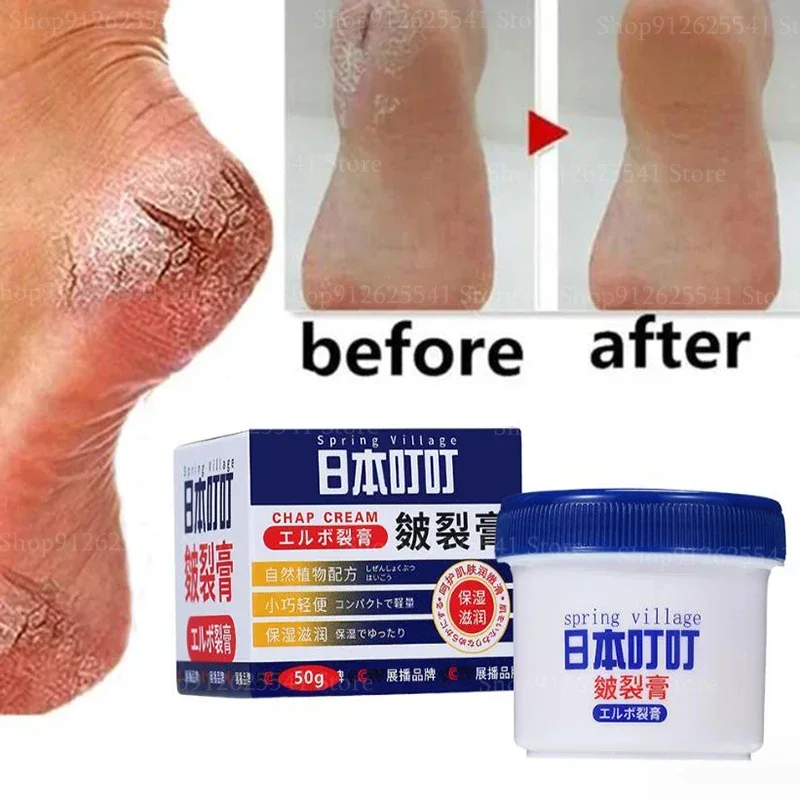 50g Anti Freezing Anti-Drying Crack Foot Cream for Removing Dead Skin and Dry Heels Hand and Foot Protection Cream