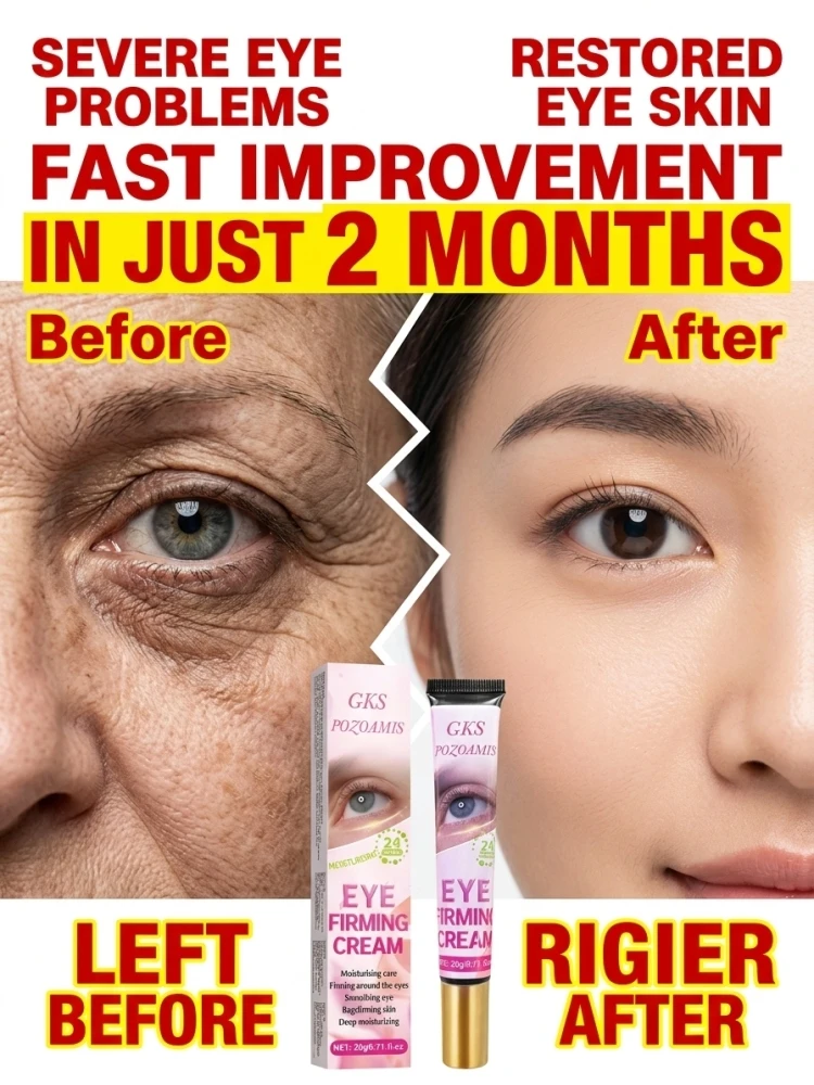 Hydrating Anti-Fine Line Eye Cream, Deeply Moisturize Dry Skin Around Eyes, Improve Fine & Dry Lines, Eye Puffiness, Dark Circles and Sagging Under Eye Skin Appearance