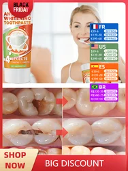 Hot selling scientific fluoride repair tooth decay removal