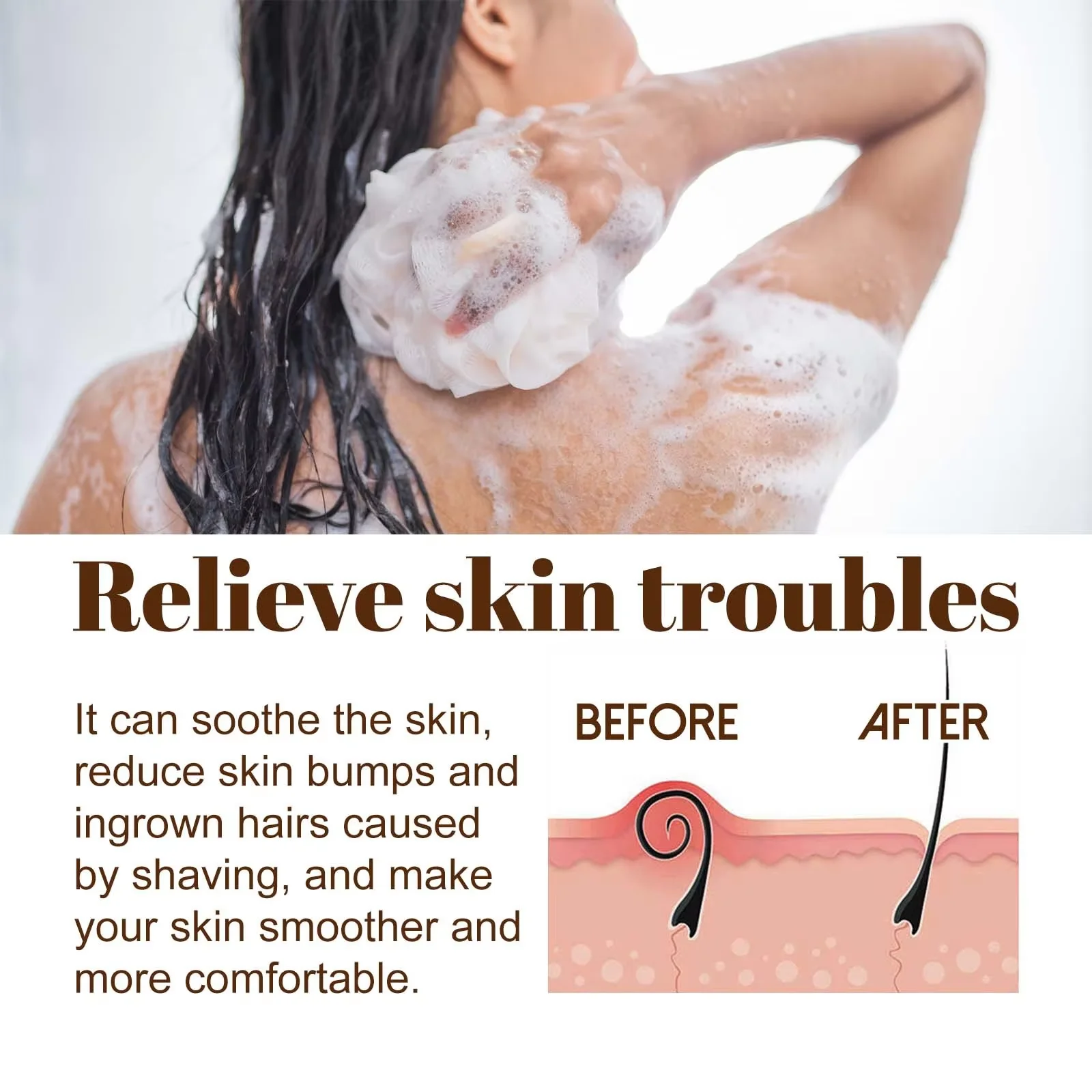 Thumbnail 3 - #67 Most Reviewed Dead Skin Removers