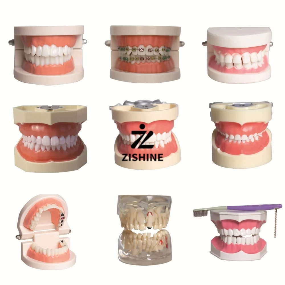 Dentistry Teeth Model Removable Typodont Tooth Model Oral Study Teaching Demonstration Implant Orthodontic for Dental Clinic