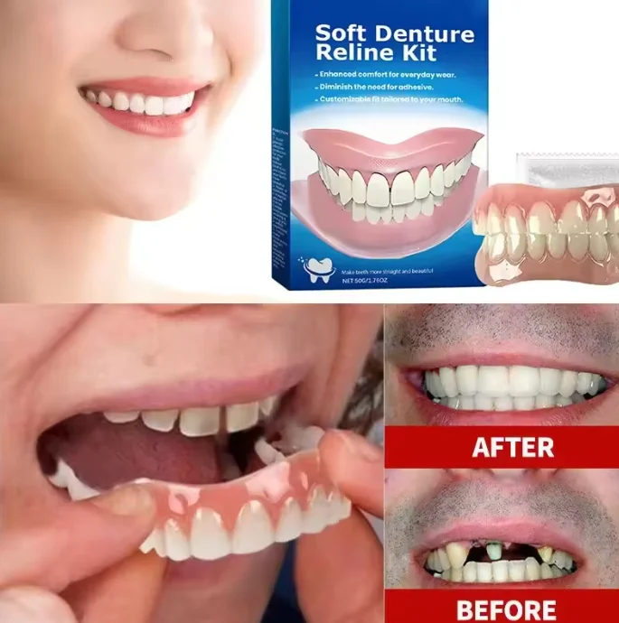 

New Denture Silicone Kit Silicone Liners Soft Denture Kit Soft Kit Teeth Upper And Lower Set Easy Use