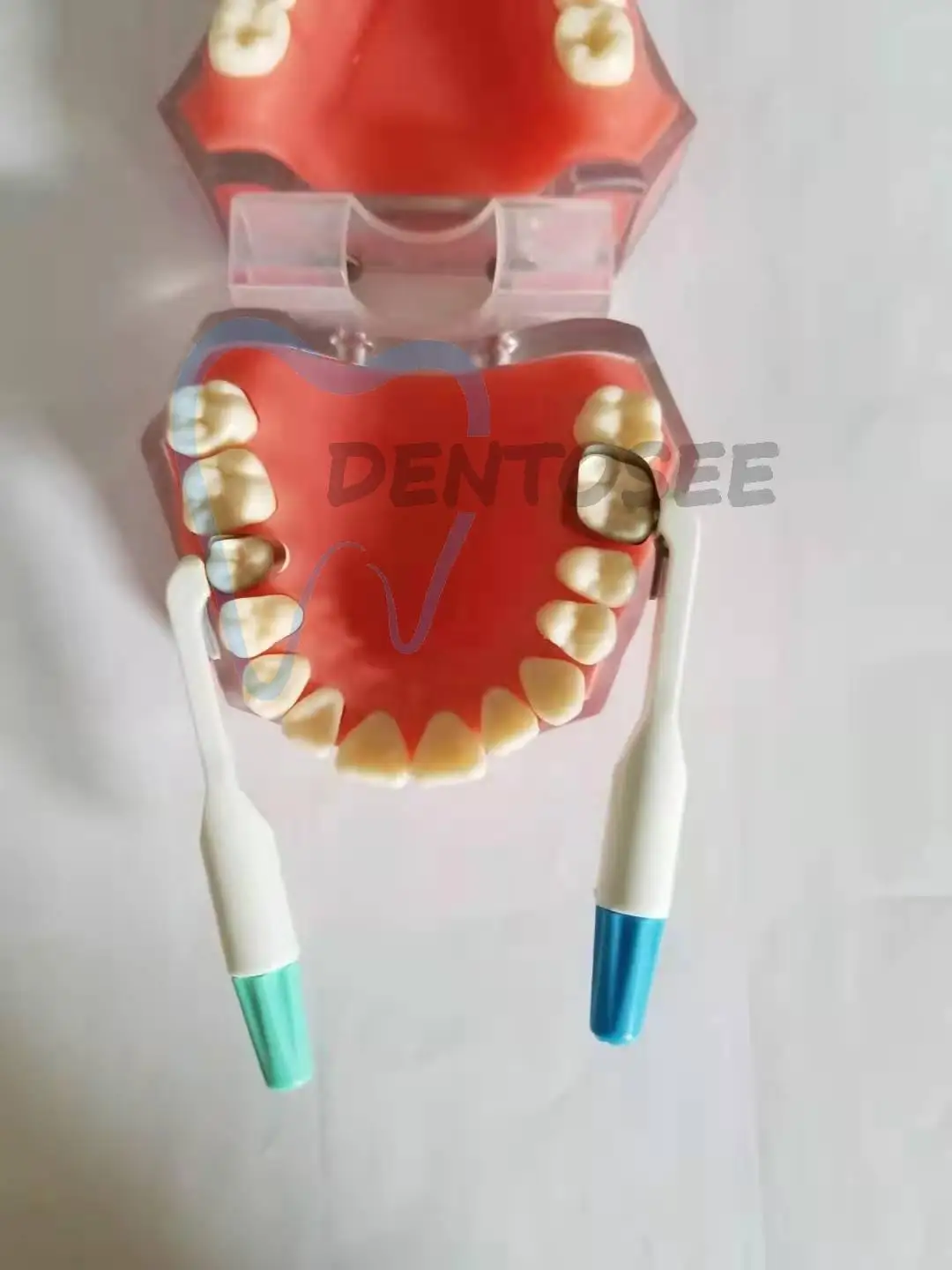 5 قطعة شريط مصفوفة الأسنان مصفوفة نظام حلقة قابل للتعديل الفولاذ المقاوم للصدأ العصابات القياسية المنحنية المسبقة لاستعادة الأسنان