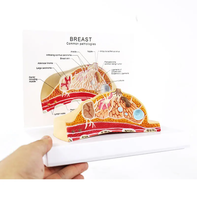 Life Size Human Female Median Section Breast Pathology Anatomy Model Kit Table-type breast lesion  lactating breasts