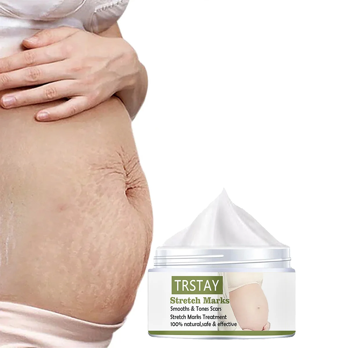 

TRSTAY крем для восстановления шрамов от прыщей и шрамов, натуральный противовоспалительный уход за кожей, безопасное лечение страй для беременных для женщин и детей