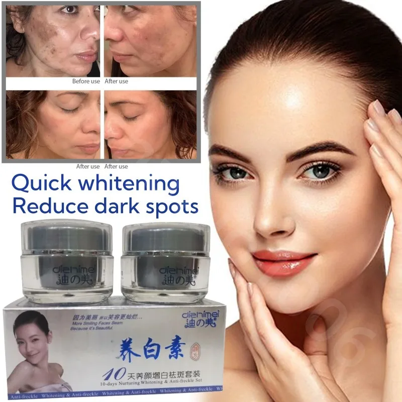 

Anti-Pigment Face Whitening Cream Powerful Effects Whitening Anti Freckle Melasma Bleaching Remove Dark Spots Skin Care Products