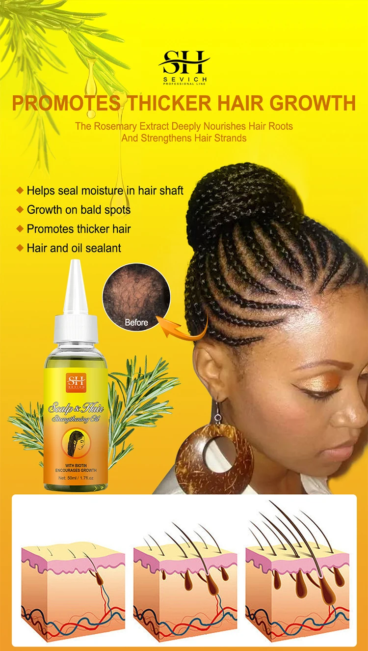 2023 new 50ML Hair Antipruritus Growth Oil for braids protective hairstyles relieve itchyand flaky scalp prevent hair loss