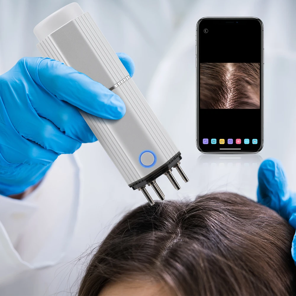 

Wireless Portable Hair Analyser 30W HD 20x Camera 3 Vibration Modes Anti-Hair Loss Scalp Applicator Liquid Comb Tool Hair Care