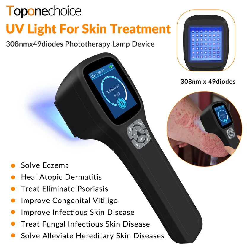 49pcs Diodes 308nm UV Light Ultraviolet Phototherapy Device UVB Lamps Treatment Vitiligo Psoriasis Eczema Skin Diseases