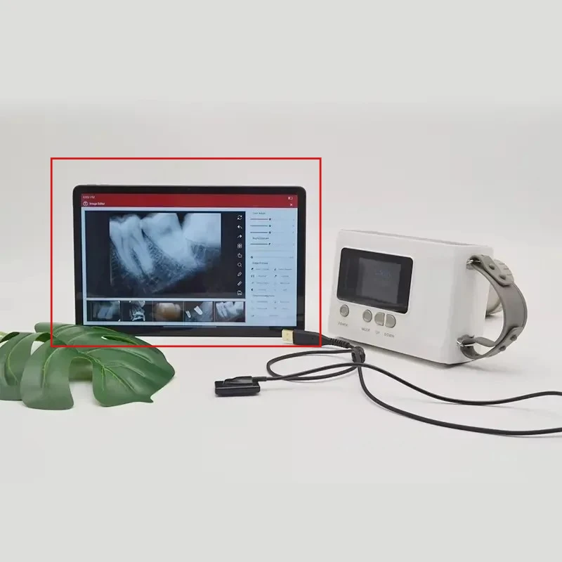 S804 Portable Digital X-ray Imaging System Tablet Computer with Handy Software Hot Selling Medical Grade for Diagnostic Imaging
