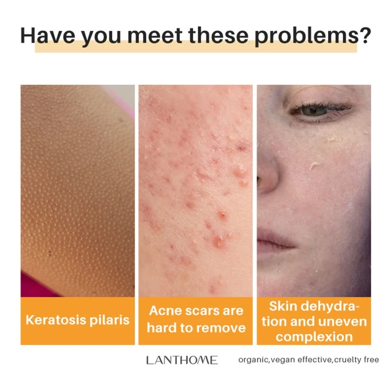 Xà phòng Axit Kojic Xà phòng làm sáng da Mặt & Xà phòng làm sạch cơ thể Làm sáng và làm đều màu da Xà phòng tắm cho hầu hết các