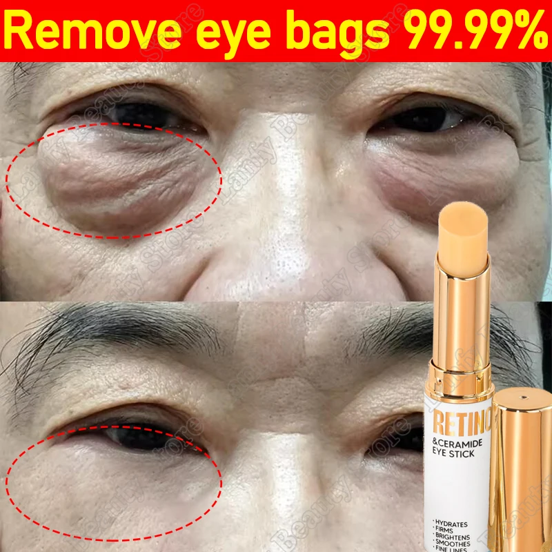 

Retinol Eye Cream Anti-wrinkle Eye Balm Stick Anti-Puffiness Remove Dark Circles Eye Bags Fade Fine Lines Moisturizing Products