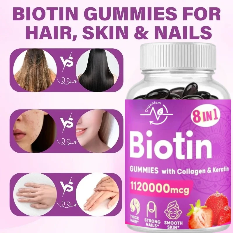 

Биотинные жевательные конфеты с коллагеном и кератином для волос, кожи ногтей, витамины, добавка для роста и здоровья