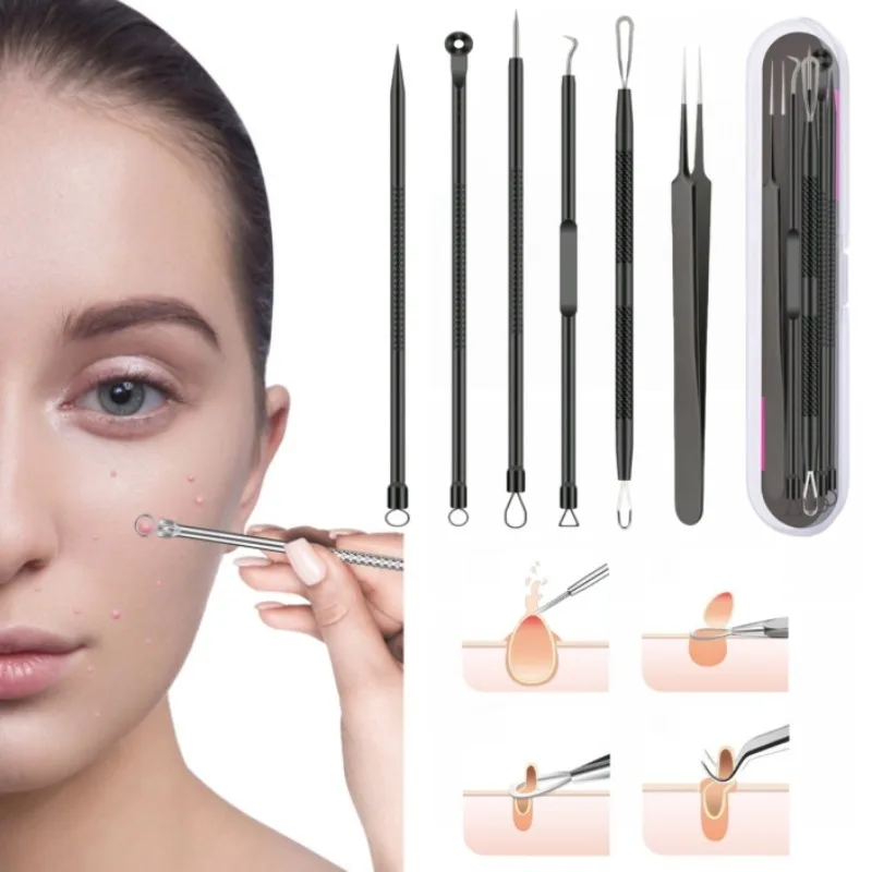 4/6Pcs/Set Acne Removal Needle Stainless Steel Clip Blackhead Removal Tool Blemishes Extractor Facial Skin Care Pore Clean Tools
