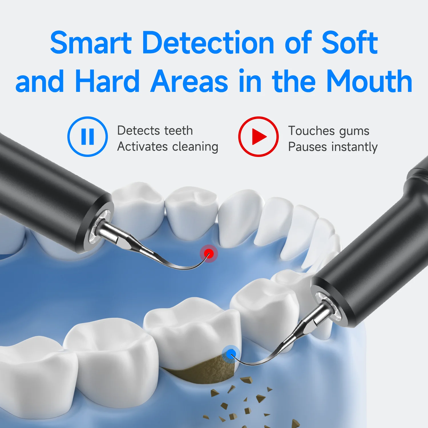 Thumbnail 3 - #30 Highest Rated Ultrasonic Scalers to Buy in 2026