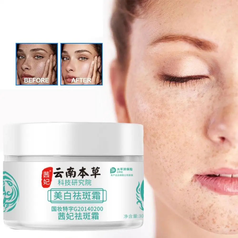 

20g Herb Powerful Whitening Freckle Cream Remove Acne Spots Dark Spots Face Moisturizing Face Skin Care Beauty Yun Nan