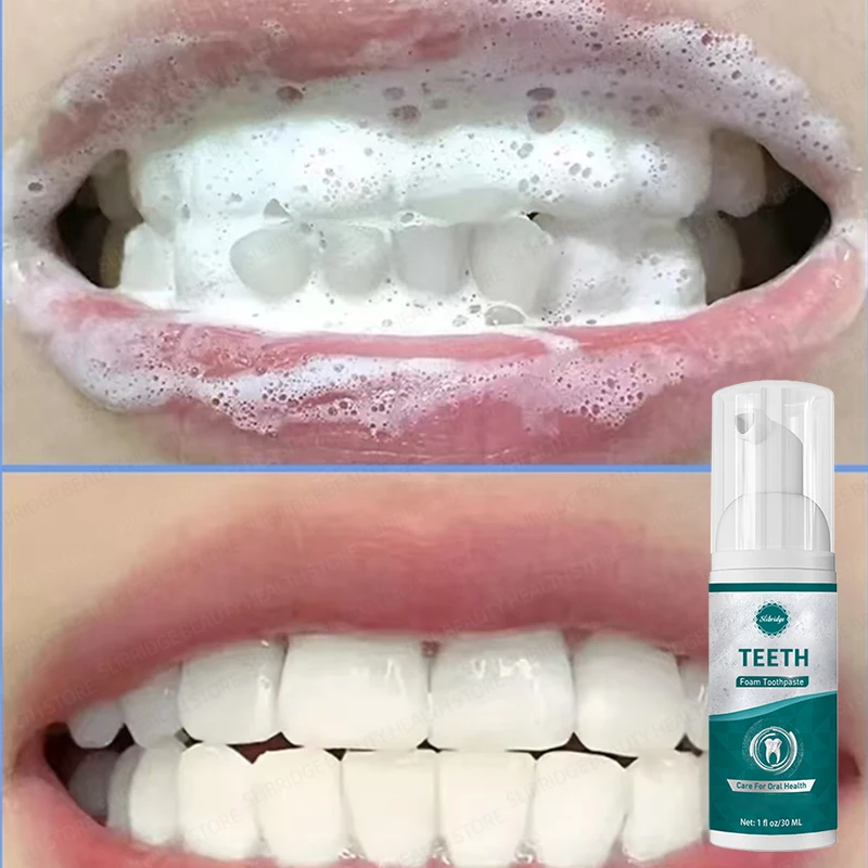 

Зимняя отбеливающая пена для зубов с гидроксипататом 10%, удаляющая, прохладная мята, ремонт эмали и свежее дыхание