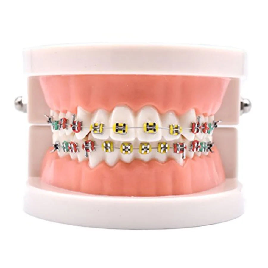 

1 Piece Dental Demonstration Orthodontic Model with Metal Wires and Bracket Metal Bracket