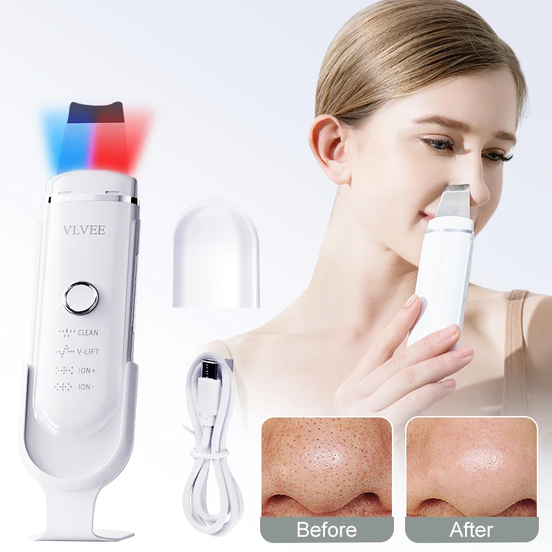 

VLVEE Ultrasonic Skin Scrubber Face Spatula Blackhead Removal Device Deep cleansing facial Pore tools Red and blue light