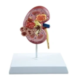 

Pathological Kidney Model Medical Science Human Anatomy Simulator Educational Assistance Teaching Aids for Middle School