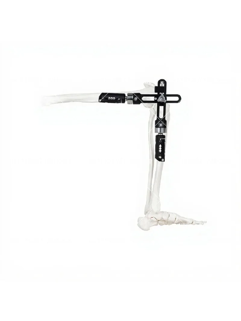 High Quality Orthopedic External Fixation Knee Fixator Support Brace