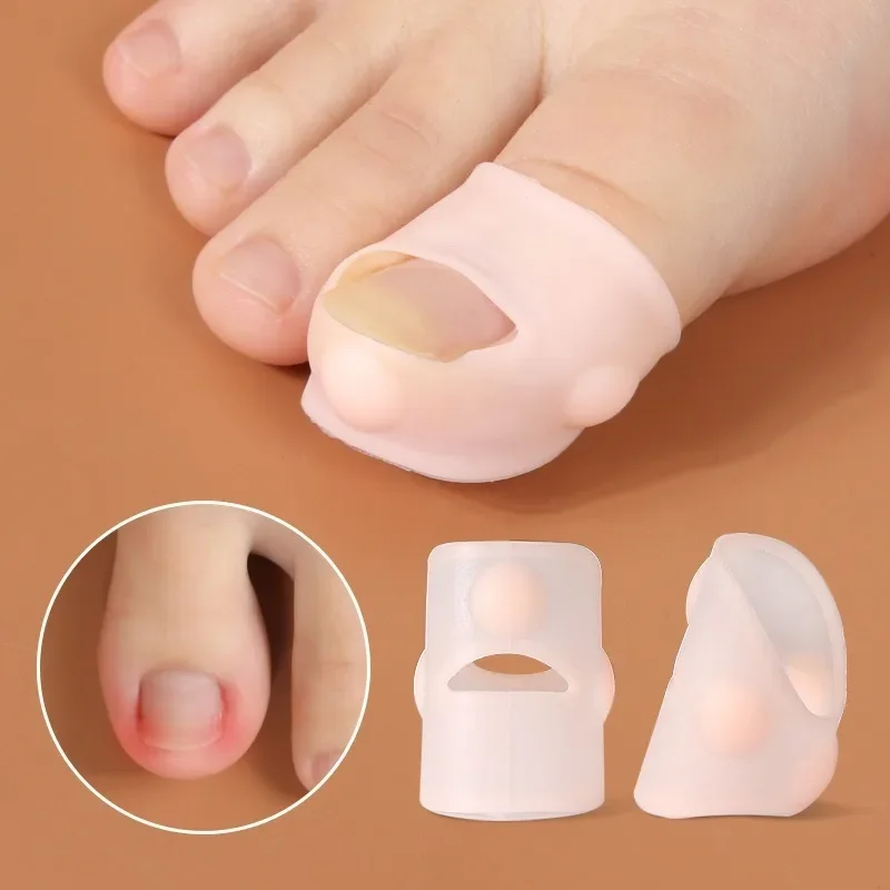 2pcs Ingrown Toenail Corrector Sleeves - Pain Relief & Nail Growth Prevention, Odorless Foot Care