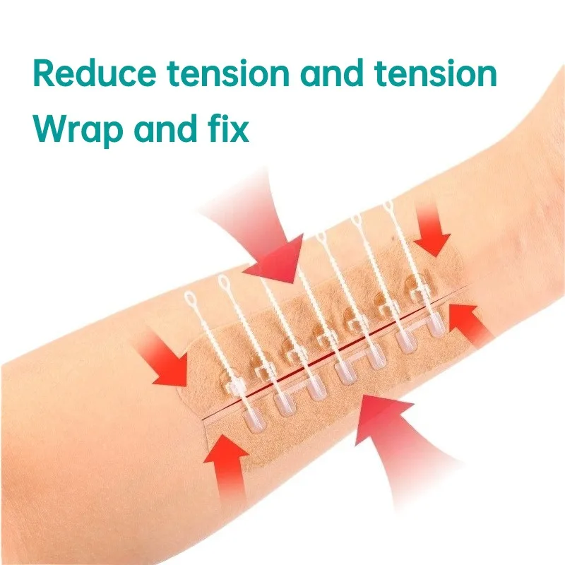 

1pcs Zipper Tie Wound Closure Patch for First Aid Portable Emergency Wound Care Postoperative Wound Closure Without Suture