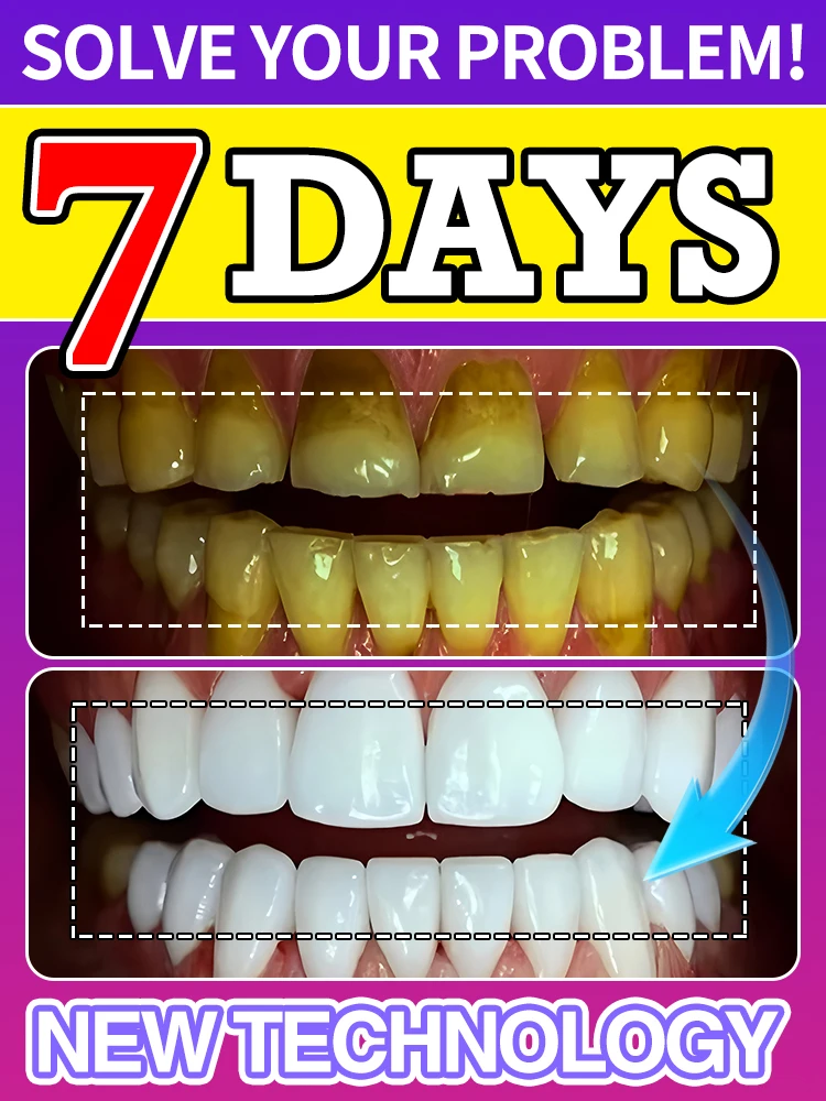 

Whitening products suitable for sensitive teeth Eliminate bad breath and prevent periodontitis Teeth Whitening For Red Wine Sta