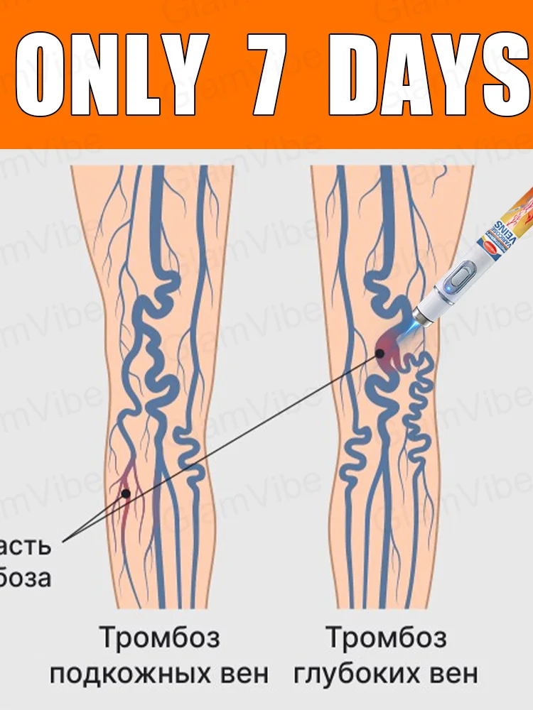 

Generation-2 Laser Says Goodbye To Spider Legs Varicose In 7 Days