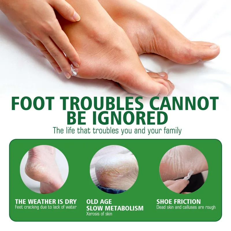 Heel Cracked Care Balm Anti Crack Foot Cream Herbal Anti-Drying Chapped Repair Balm Dead Skin Remove Moisturizing Hand Feet Care