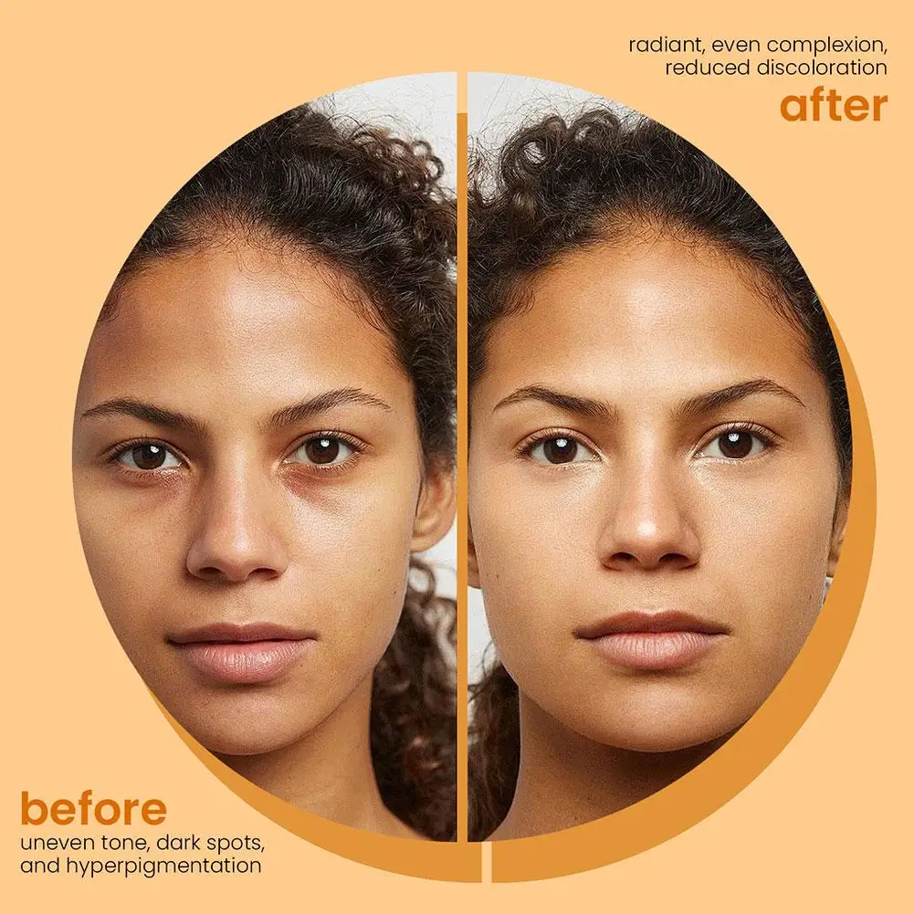 1/3/5개 유기농 레몬 강황 코직산 비누 (기미/잡티 완화) 강황 비누 페이스 워시, 칙칙한 피부톤 개선 스킨케어