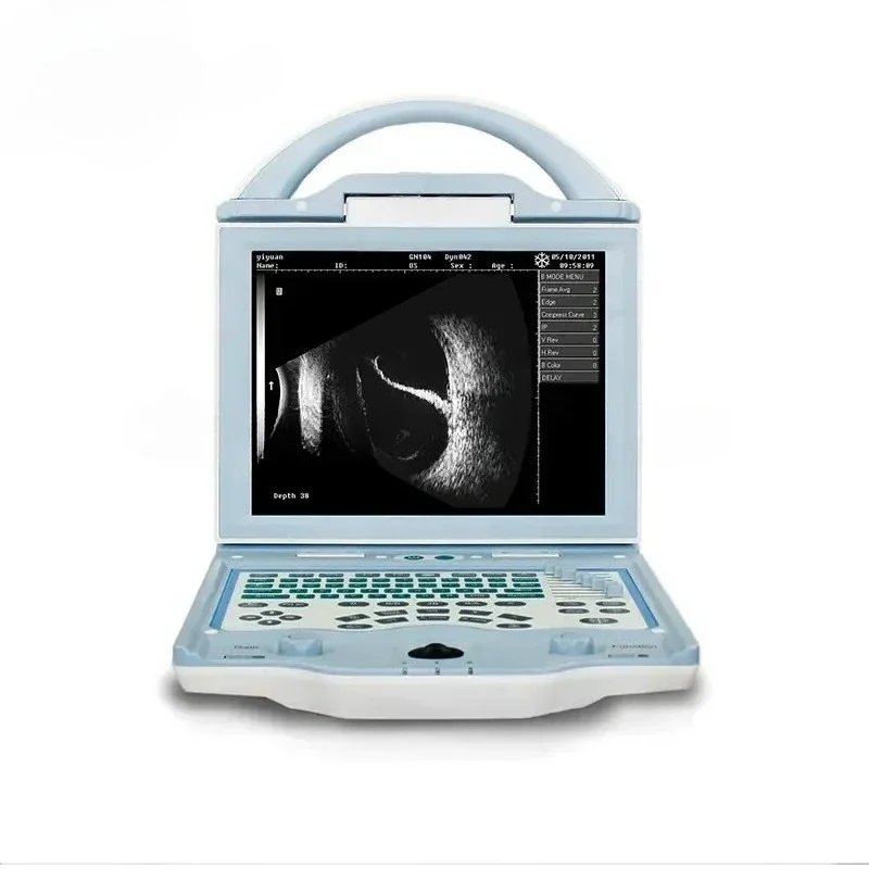 US101 Cheap Eye Scanner Portable Full Digital A/B Ophthalmic Ultrasound Equipment Price
