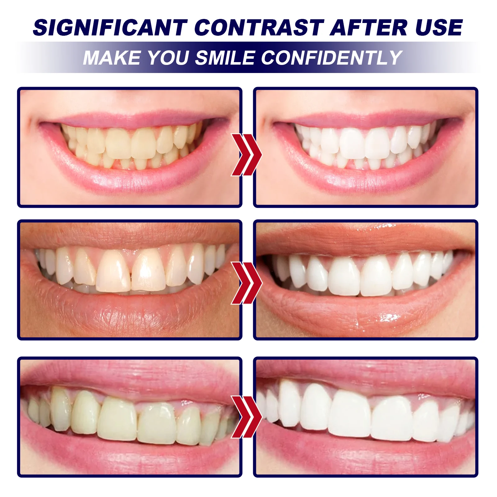 Teeth Whitening Strips.Teeth Cleaning Products Decompose Pigments To Improve Teeth Brightness and Remove Dirt Kit