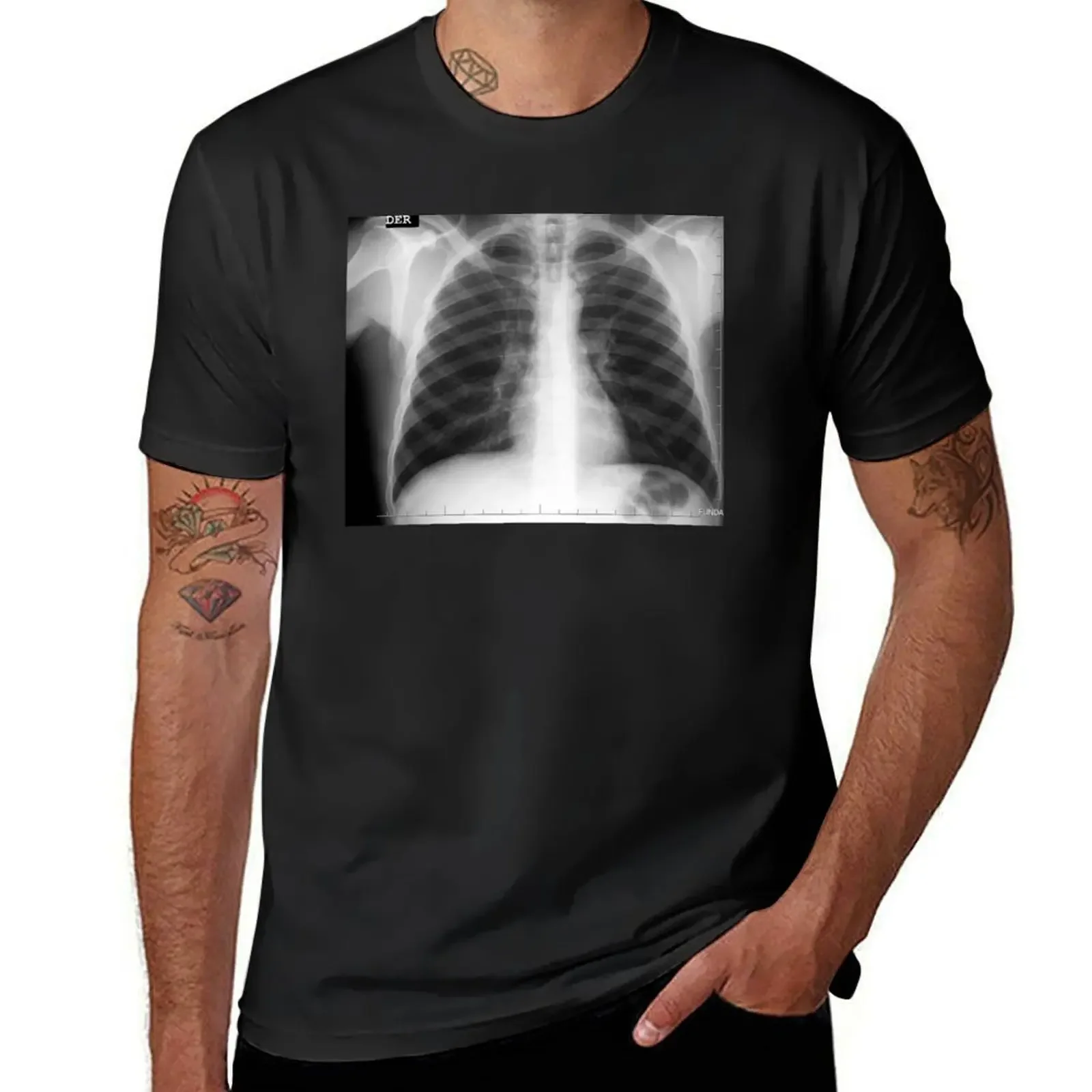 Radiographer X Ray Medicine T-Shirt summer top plus sizes anime stuff anime tshirt mens fashion