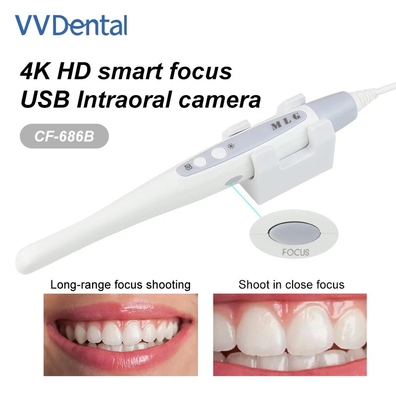 VV Dental 13MP Intraoral Camera No Delay and Smart Focus 4K Image USB Intra Oral Camera With Induction Bracket CF-686B