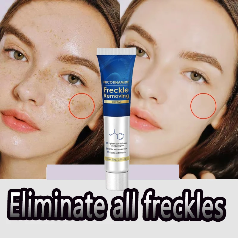 

Freckle Removing Cream Blemish Reduces Chloasma Age Spots Dark Spot Sun Spots Lightening Face Cream Korean Skin Care