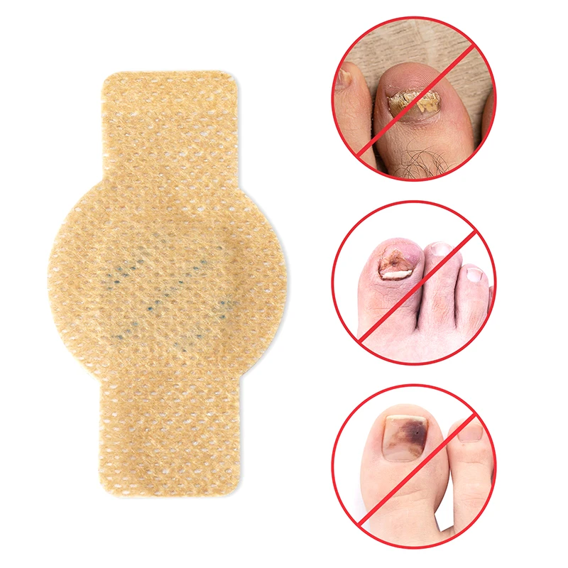 21Pcs Nail Fungus Patch Waterproof Nail Repair Patch Ingrown Correction Sticker Discolored Damaged Nail Gray Care Patches